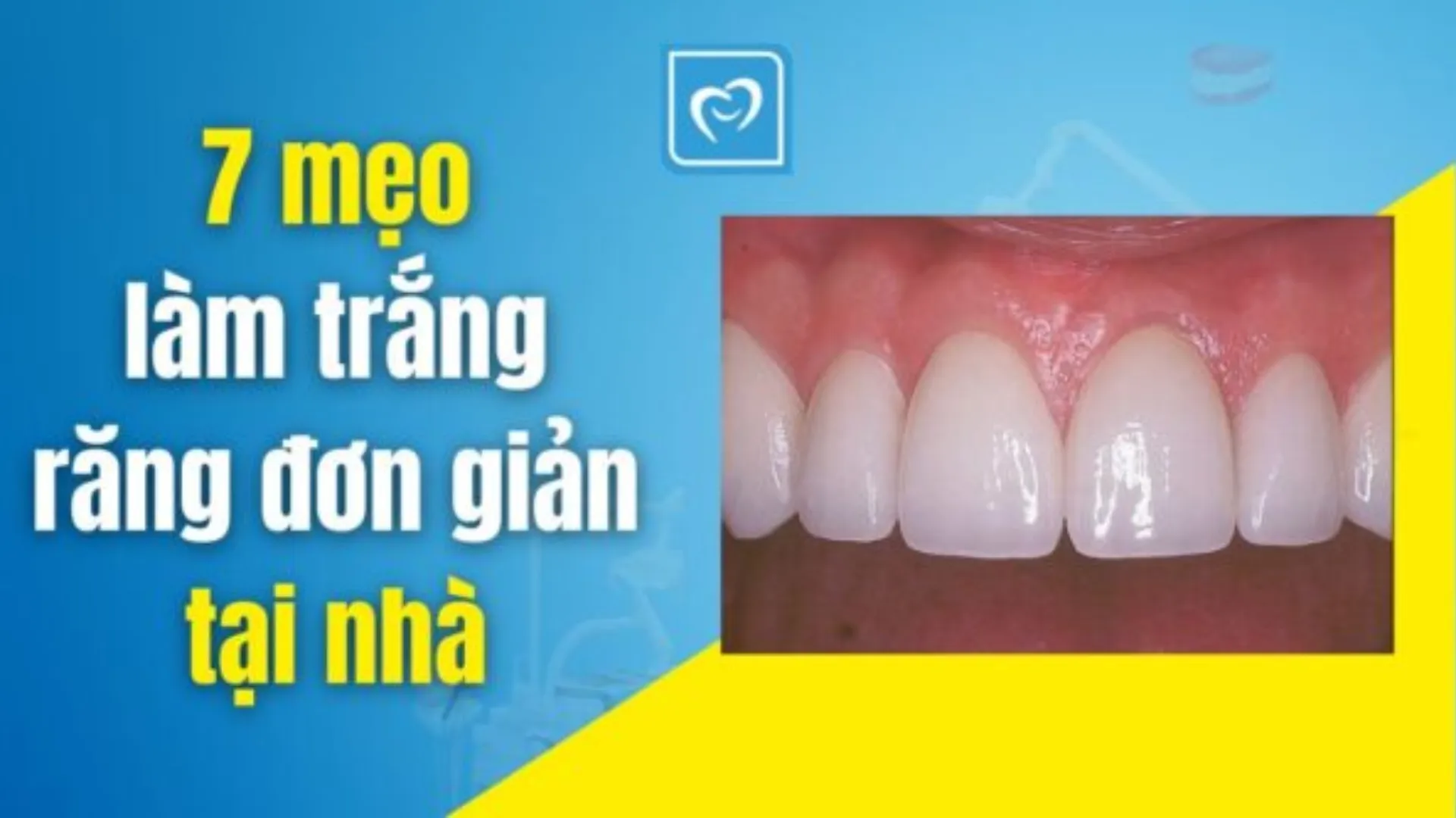 7 mẹo làm trắng răng đơn giản tại nhà