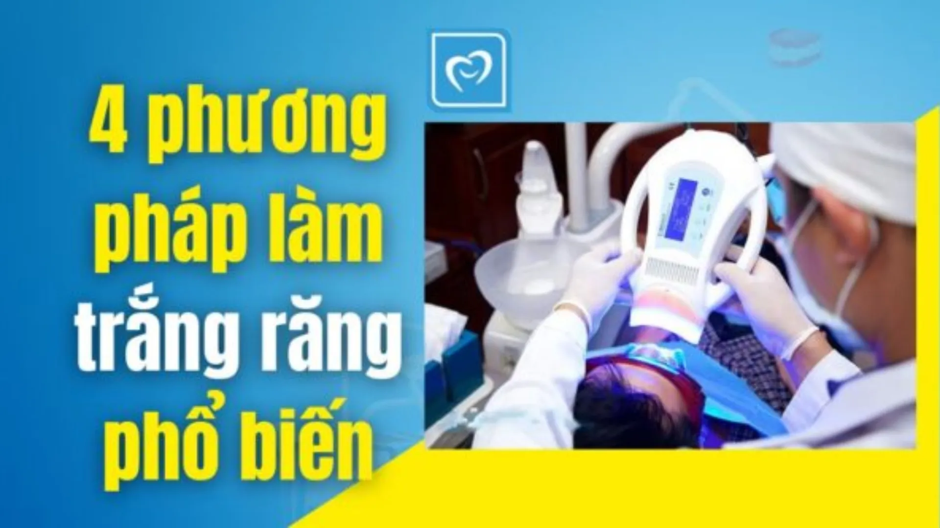 4 phương pháp làm trắng răng phổ biến- Nha khoa Bảo Ngọc