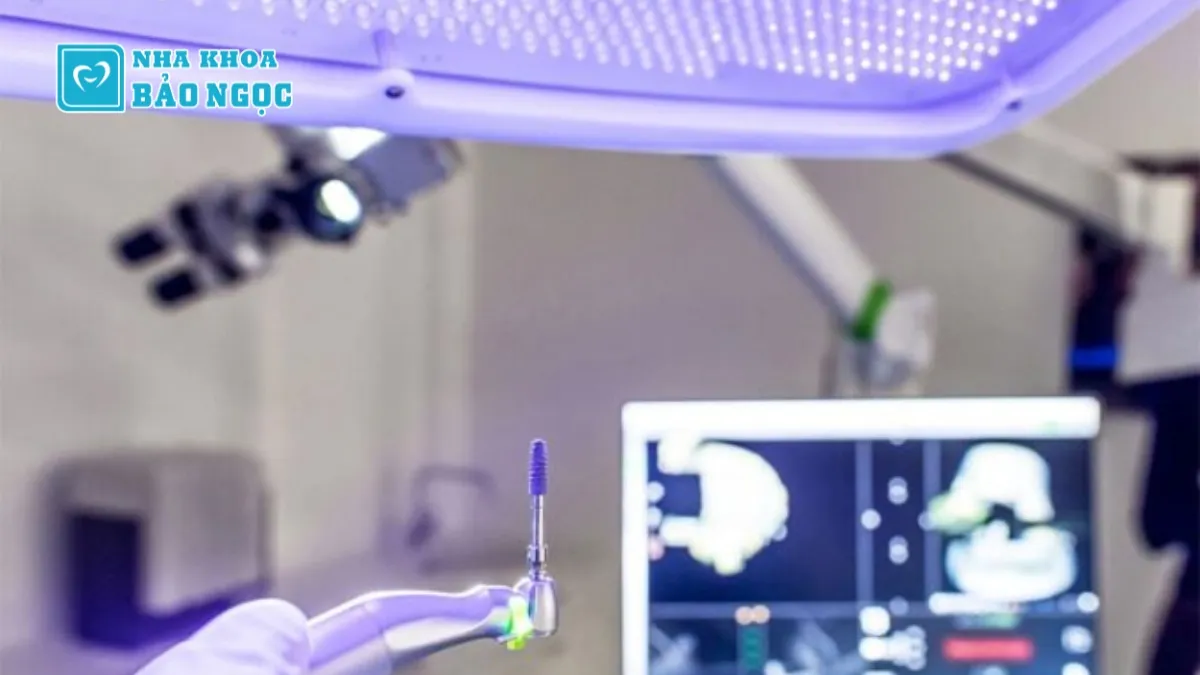 Trồng răng implant bao lâu thì lành?