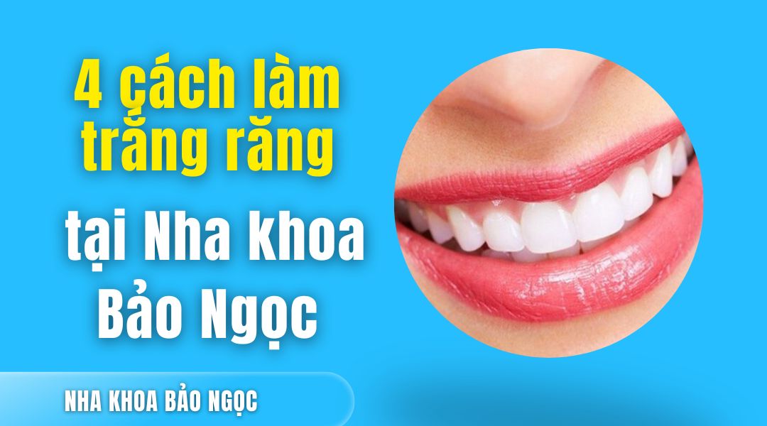 Cách làm trắng răng
