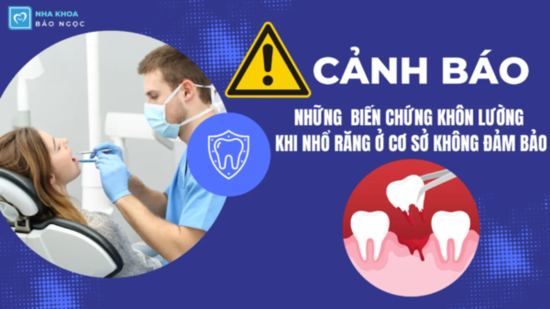 Cảnh báo những biến chứng khôn lường khi nhổ răng tại các cơ sở không đảm bảo