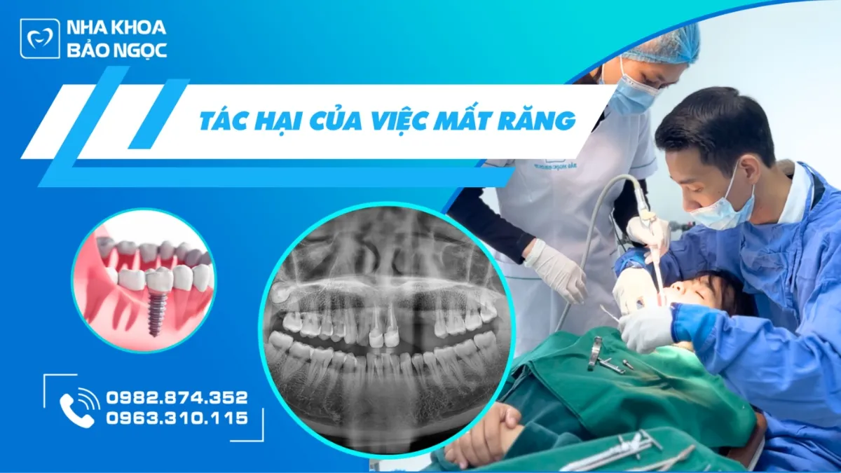 6 Tác hại của mất răng mà bạn nên cẩn thận kẻo hối hận