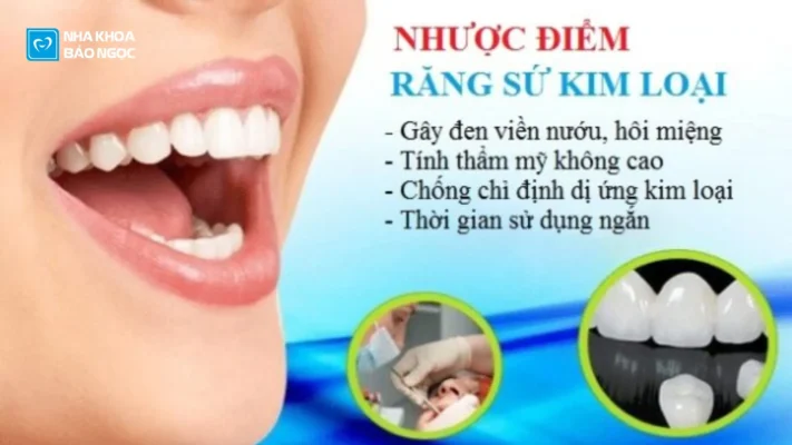 Tác hại Của Răng Sứ Kim Loại?