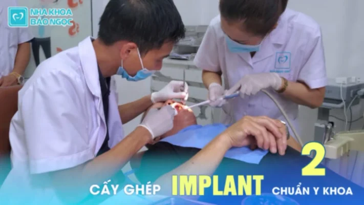 Nhổ răng bao lâu thì trồng implant?