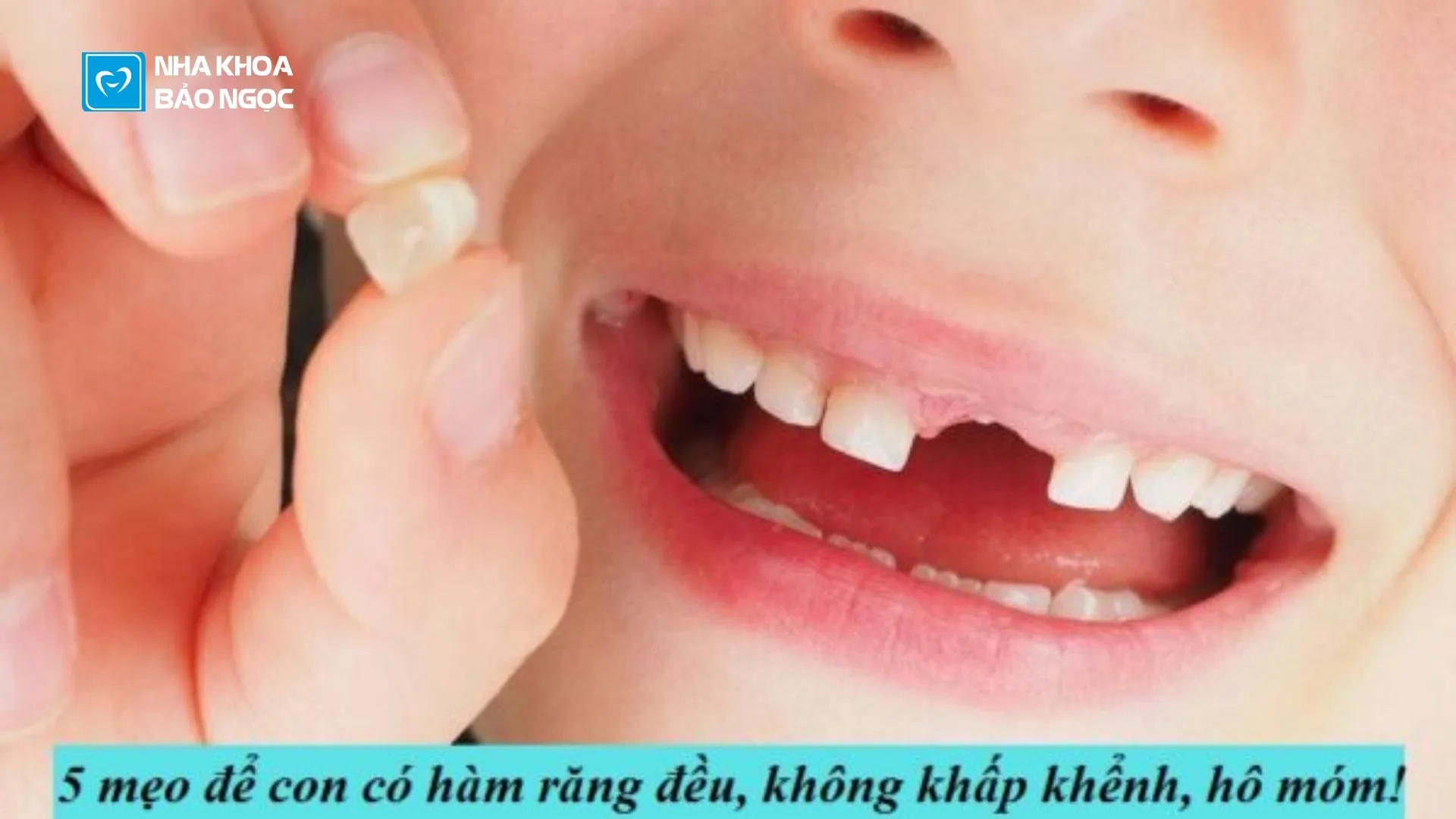 Để con trẻ có 1 hàm răng đều đặn, tránh hô móm!