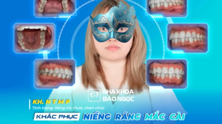 Niềng răng công nghệ số 1 - Bí quyết cho nụ cười toả sáng cùng M.P