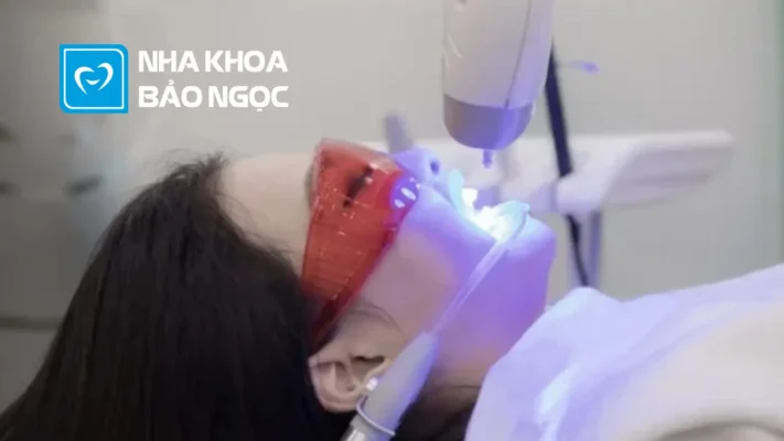 Bí quyết chăm sóc tẩy trắng răng 100% đúng cách