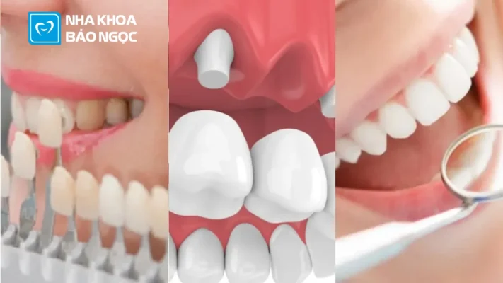 Mài răng bọc sứ có gây hại cho sức khỏe không?