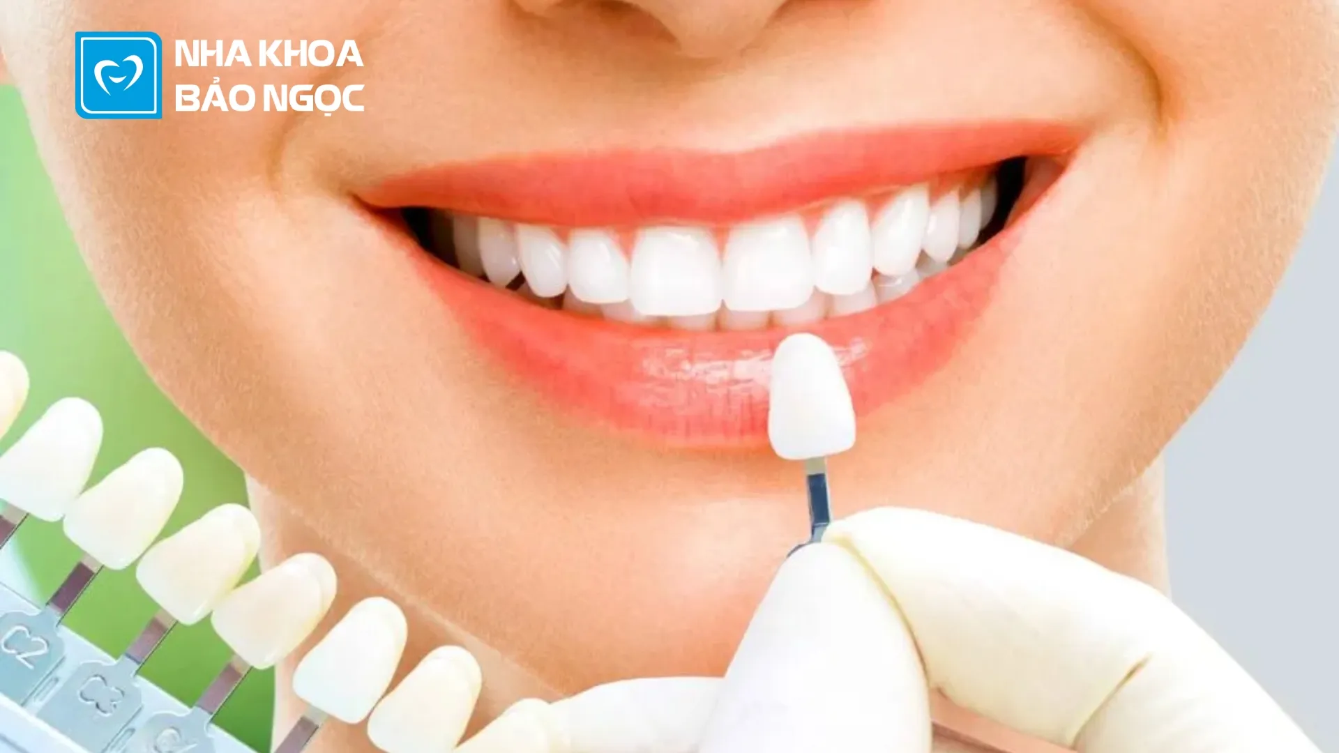 Răng sứ là gì? 4 điều nhất định phải biết khi bọc răng sứ ?