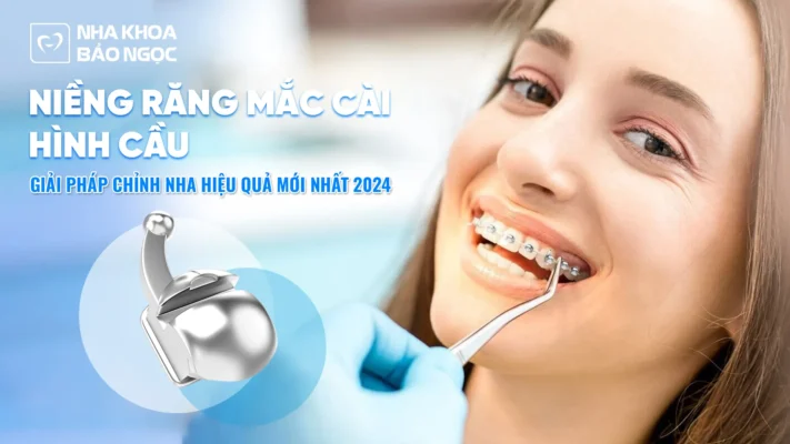 Niềng Răng Mắc Cài Hình Cầu: Giải Pháp Chỉnh Nha Hiệu Quả Mới Nhất 2024