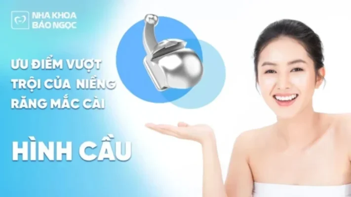 Niềng răng mắc cài hình cầu - Mắc cài có ưu điểm vượt trội số 1 hiện nay