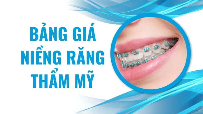 Bảng Giá Niềng Răng Thẩm Mỹ 2024: Tìm Hiểu Chi Tiết Dịch Vụ Và Chi Phí