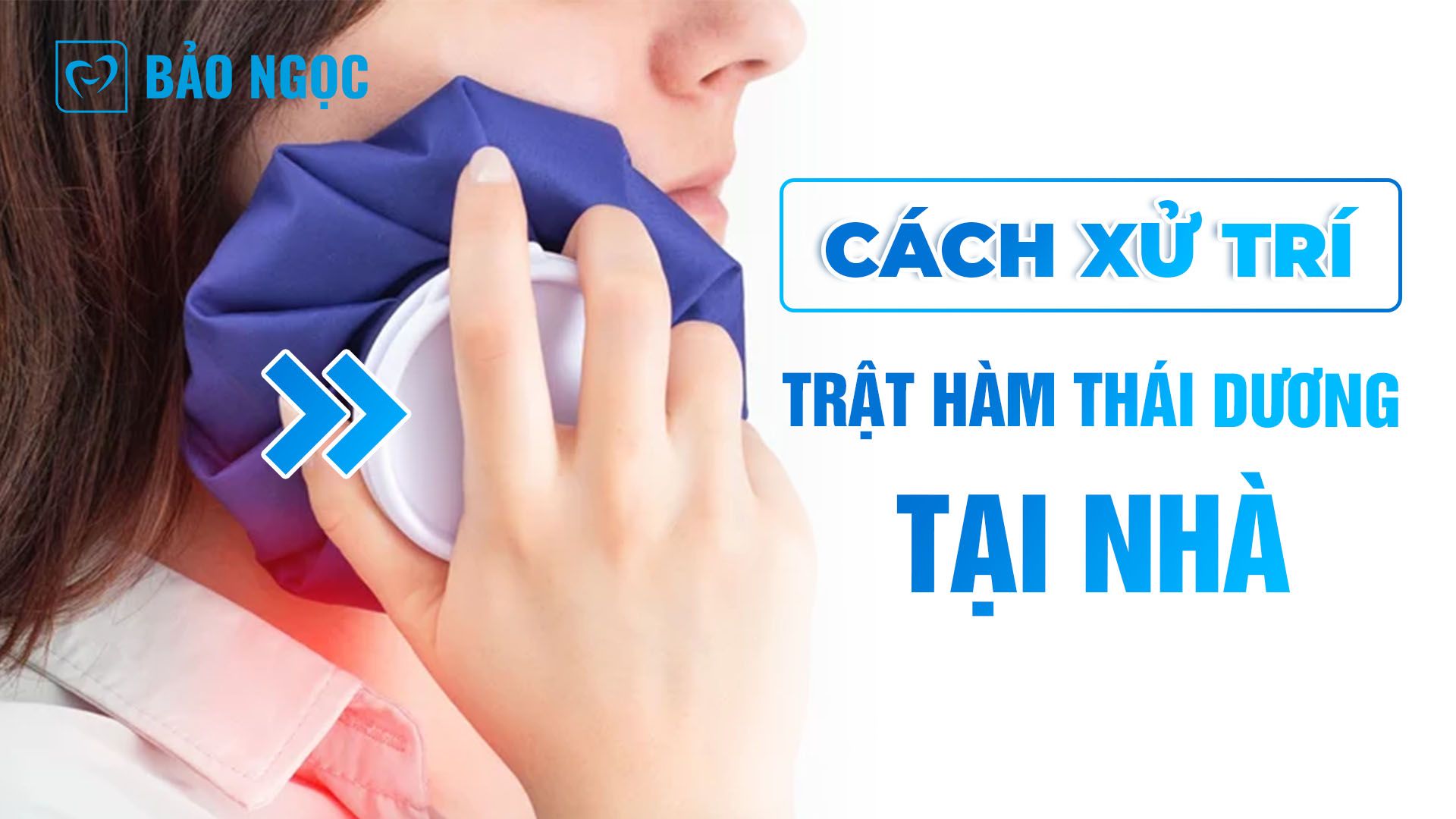 trật hàm thái dương