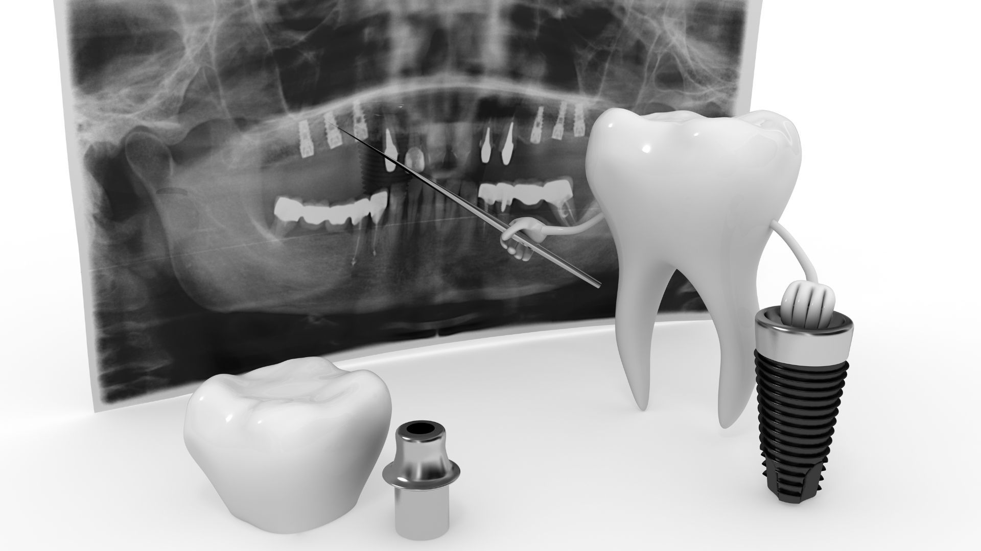 Cấy Implant công nghệ cao
