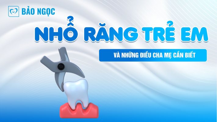 Nhổ răng trẻ em