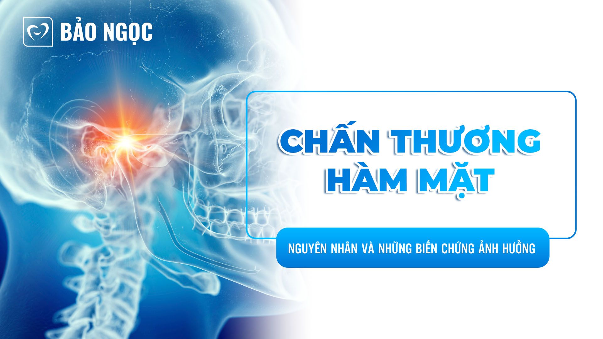 Chấn thương hàm mặt