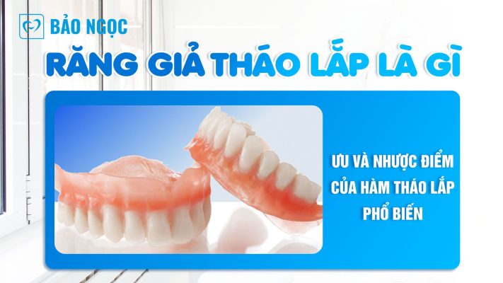 Răng giả tháo lắp
