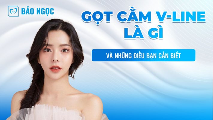 Gọt cằm V-line