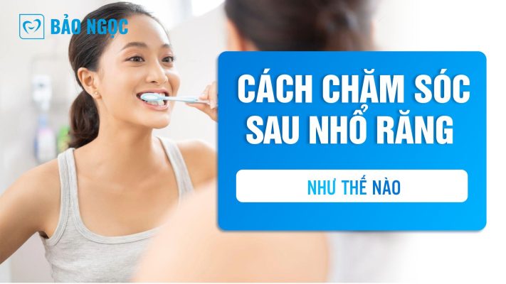 Cách chăm sóc sau nhổ răng