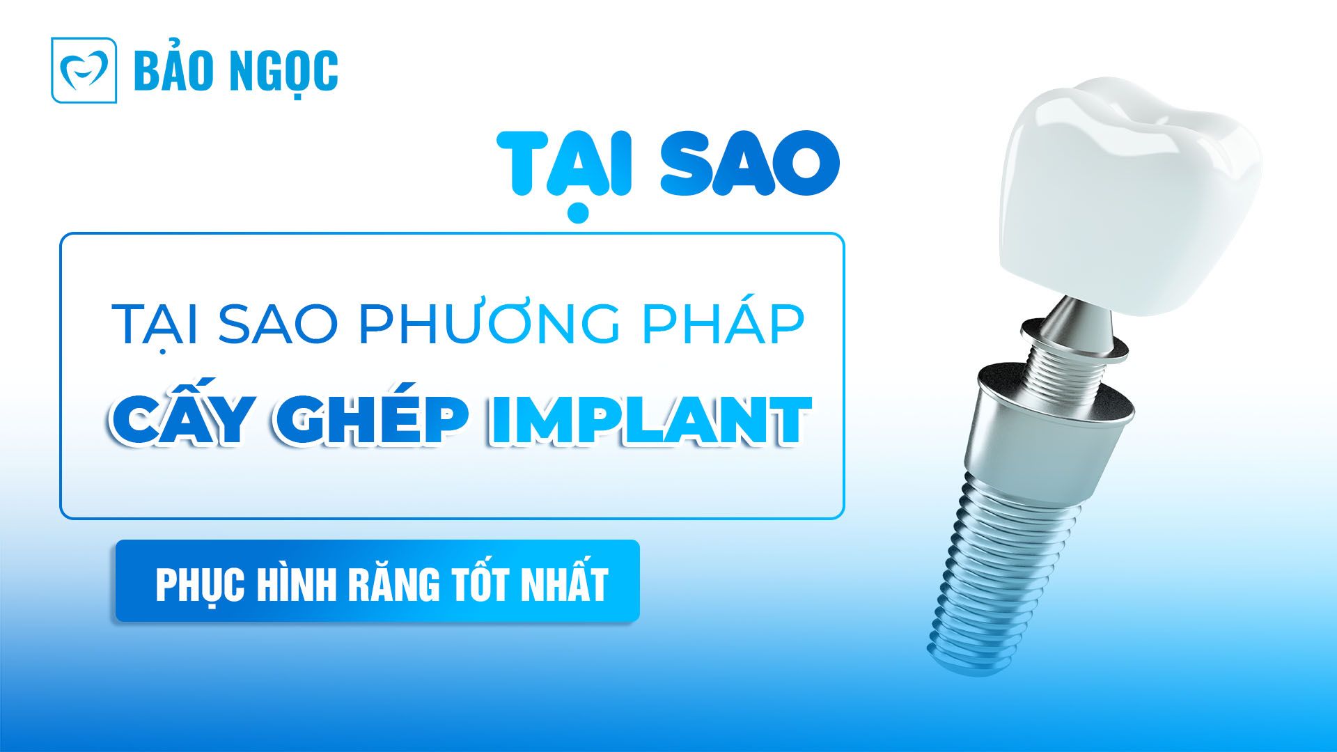 phương pháp cấy ghép Implant