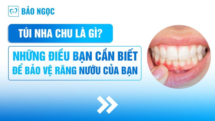Túi nha chu là gì?