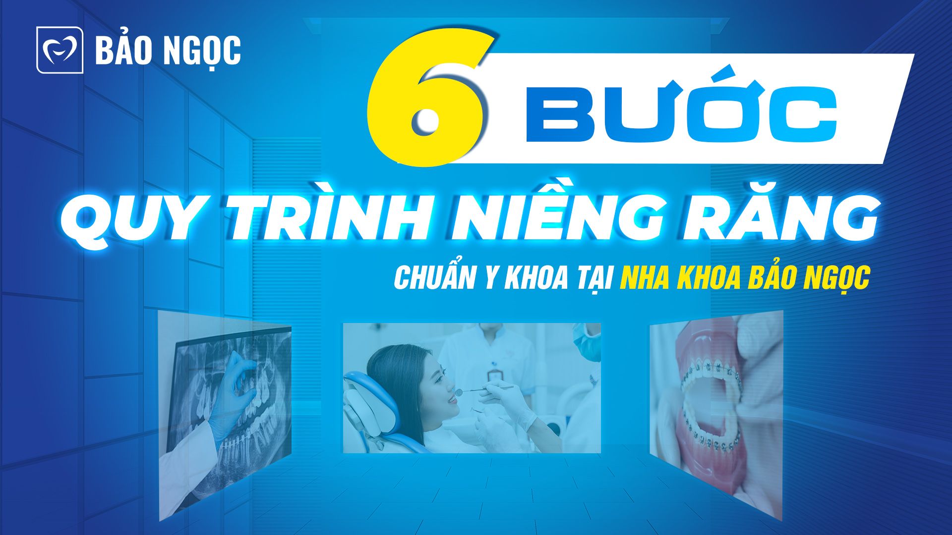 quy trình niềng răng