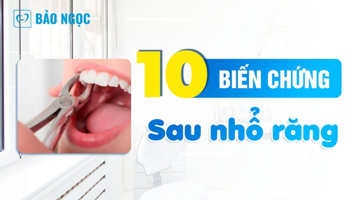 Biến chứng sau nhổ răng