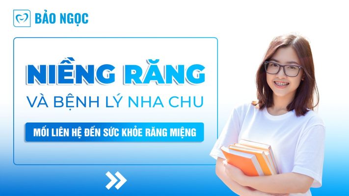 Niềng răng và bệnh lý nha chu