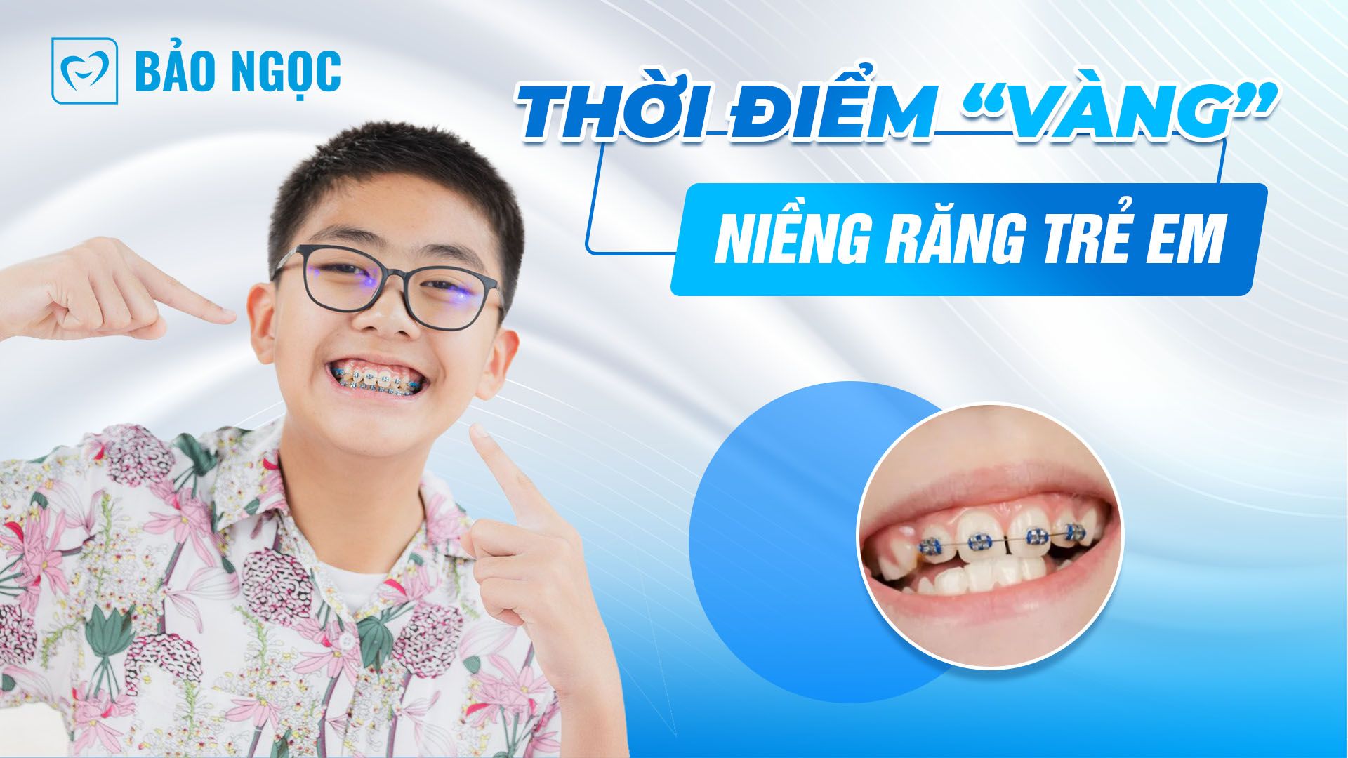 Niềng răng trẻ em