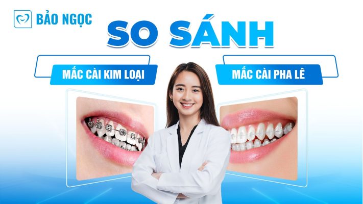 So sánh mắc cài kim loại và mắc cài pha lê
