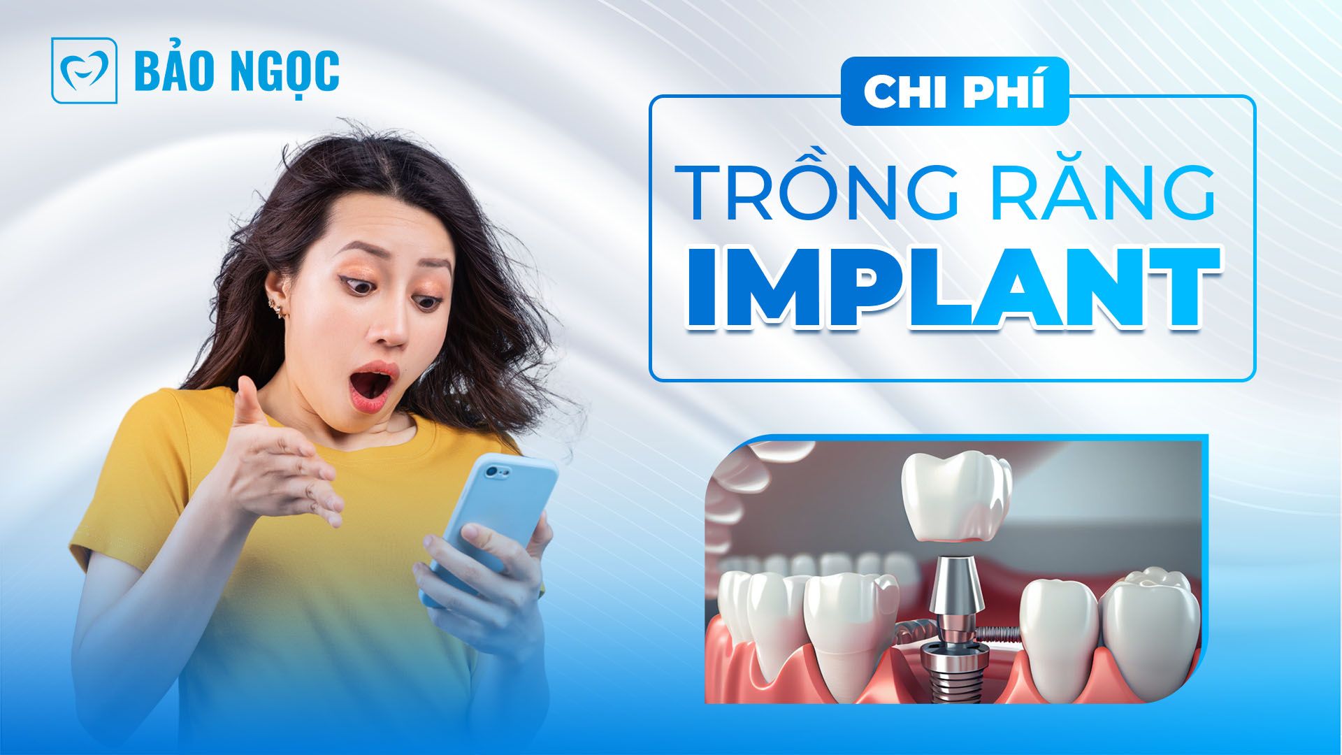 Chi phí trồng răng Implant