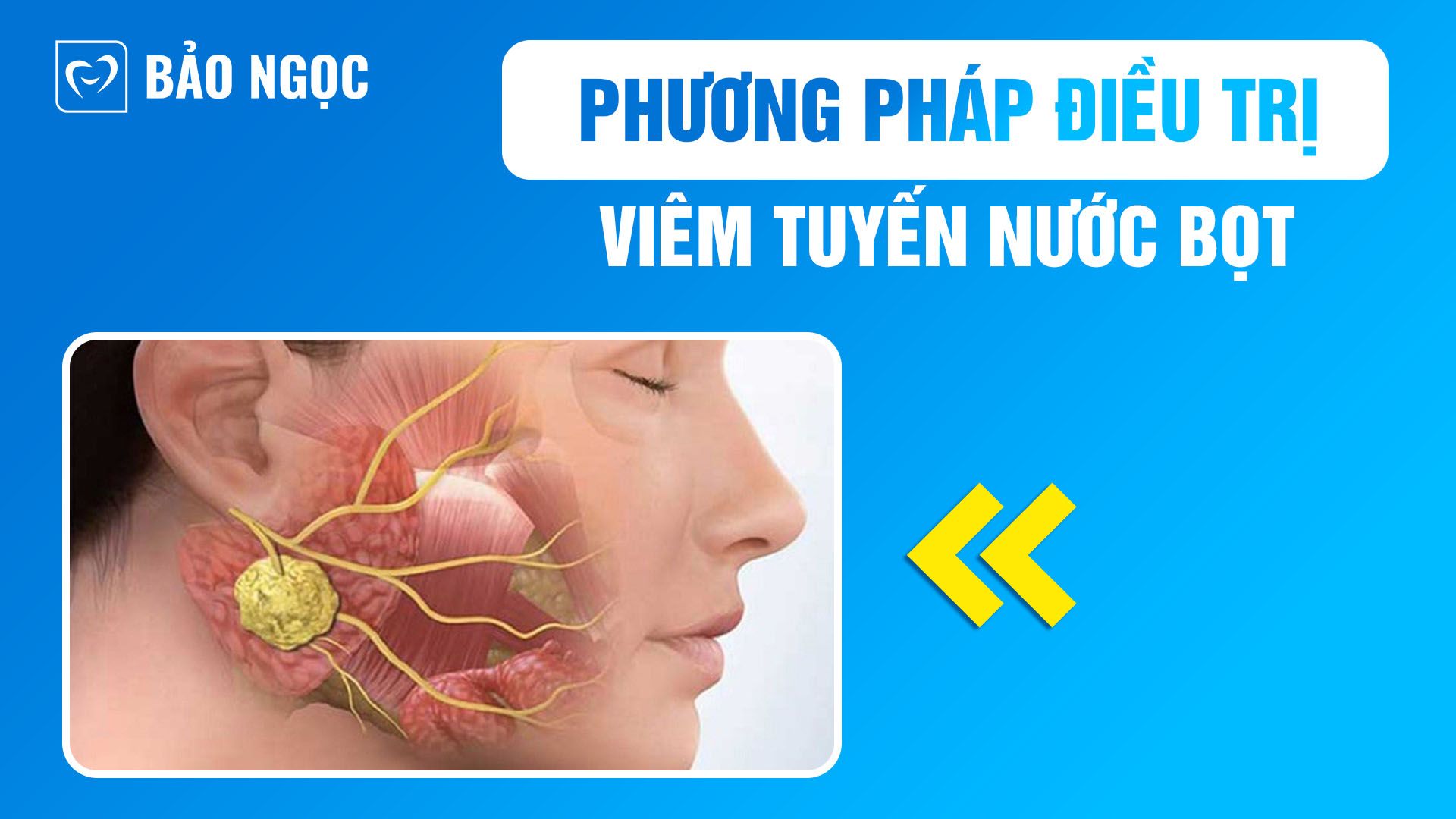 điều trị viêm tuyến nước bọt