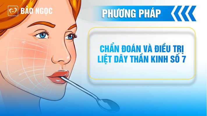 điều trị liệt dây thần kinh số 7