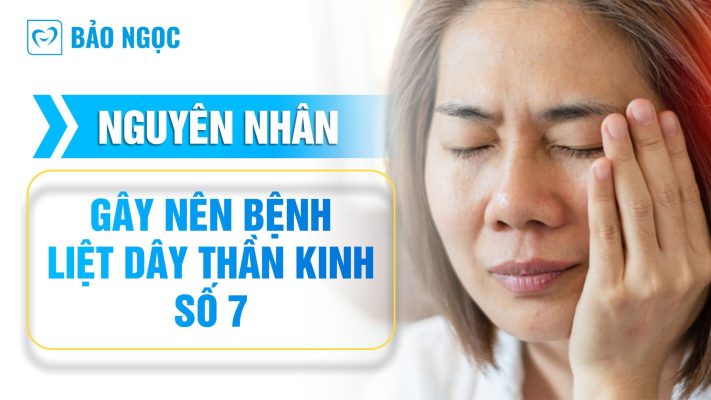 bệnh liệt dây thần kinh số 7