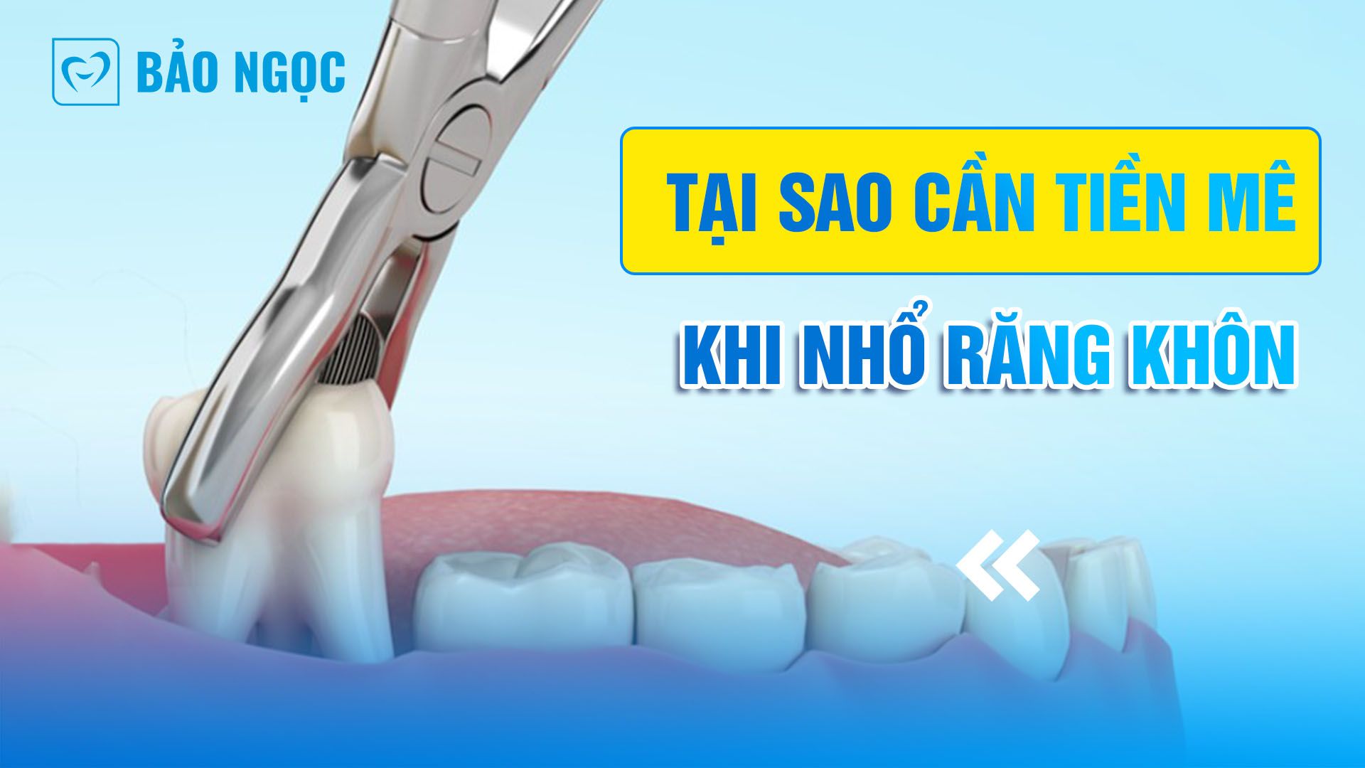 tiền mê khi nhổ răng