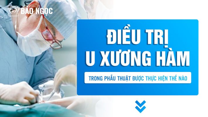 Điều trị u xương hàm
