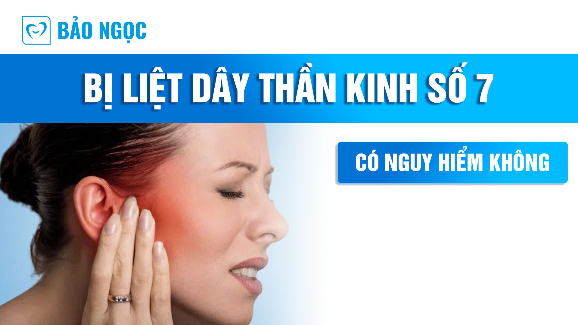 Bị liệt dây thần kinh số 7