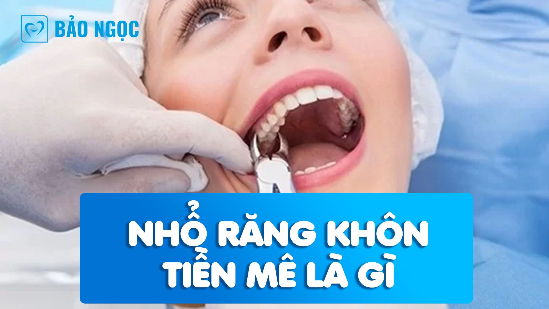 Nhổ răng khôn tiền mê