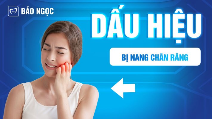 Dấu hiệu bị nang chân răng