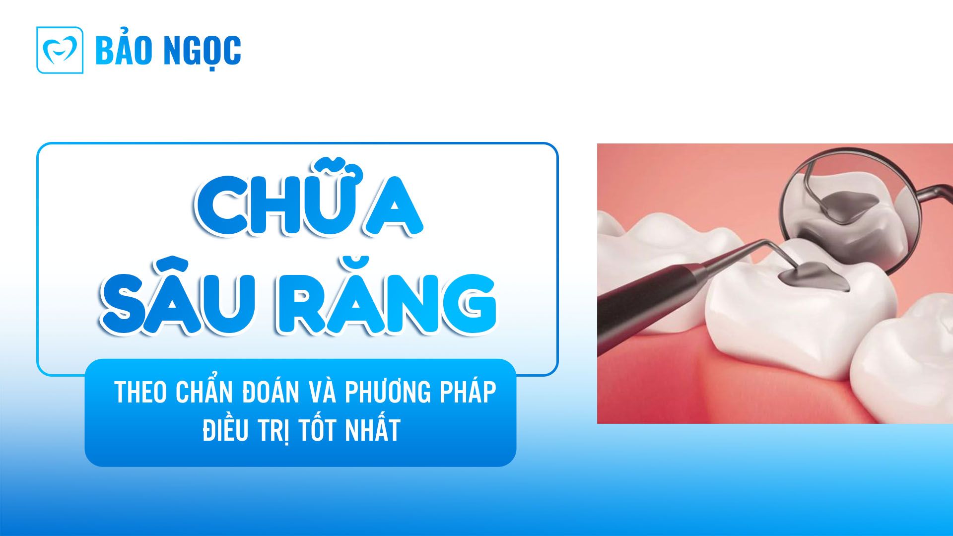 Chữa sâu răng 