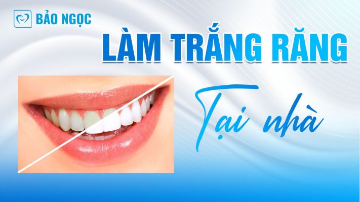 Làm trắng răng tại nhà đơn giản
