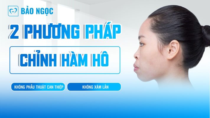 chỉnh hàm hô không phẫu thuật
