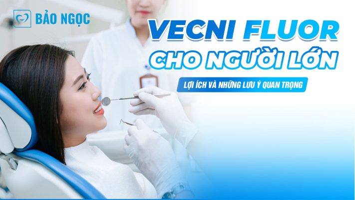 Vecni fluor cho người lớn